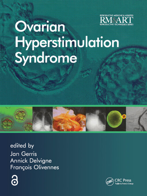 Title details for Ovarian Hyperstimulation Syndrome by Jan Gerris - Available